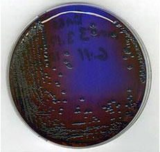 Imagen de una placa bacteriana de salomonicida rojo y verde